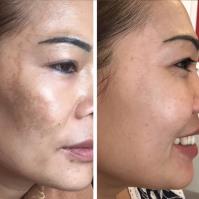 Derma Revive Skin Clinic Premier Laser & Skin image 1